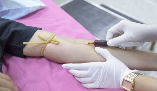 Paciente recibiendo una entrevista intravenosa en un entorno clínico.