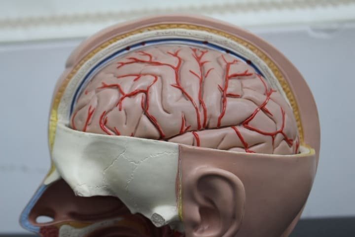 Cerebro completo